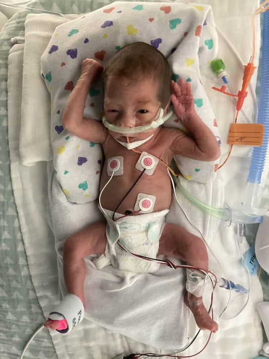 Lydia’s NICU Journey